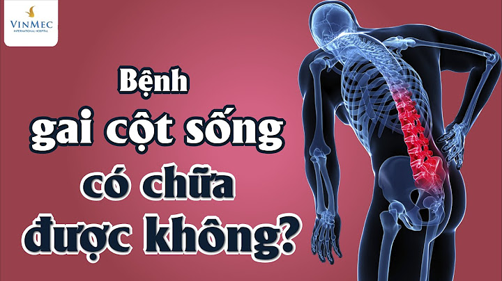 Làm sao để hết thoái hóa cột sống?