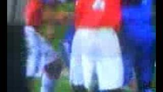 John Terry - Chelsea - Knocked Out - Carling Cup Final-Head