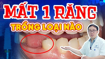 Mất 1 Răng Hàm Có Sao Không? Cần Làm Gì Để Giữ Khớp Cắn Ổn Định?