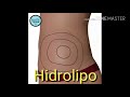 Hidrolipo