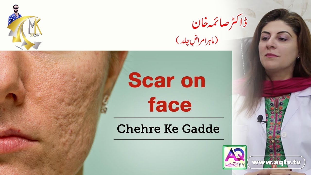 Scar on Face and very Easy Treat  Cehre ke Gadde  Dr Samia Khan  MK Show  AQ TV