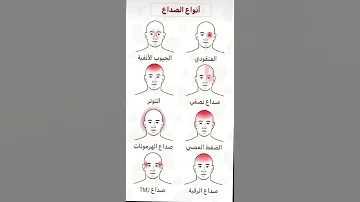 انواع الصداع الصداع النصفي صداع الجيوب الانفية التوتر نصيحة معلومة معلومة طبية الصداع 