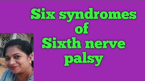 Six syndromes of sixth cranial nerve palsy// Abducens nerve// Neuro ophthalmology// MBBS// Optometry