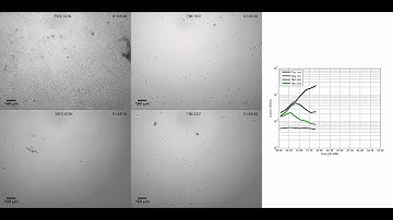 Rapid antimicrobial susceptibility testing of urine samples