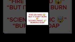 Fire on My Hand 🔥 But It Didn’t Burn 😱