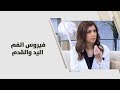 د مي ابو حاكمة فيروس الفم اليد والقدم طب وصحة د مي ابو حاكمة فيروس الفم اليد والقدم طب وصحة
