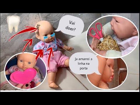 Duda está com o dente mole e tentou arrancar em casa 🦷😱/ Milli Produções