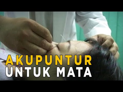 Video: Dapatkah kacamata membantu kerutan makula?