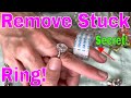 How Remove Stuck Ring on Finger. Remove Tight Ring on Finger Fast!