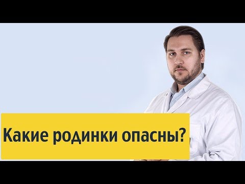 Какие родинки опасны?