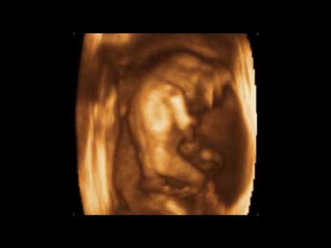 Jeniffer Baby 16 Weeks 3D 4D Ultrasound -3D 4D Ultrasound Video