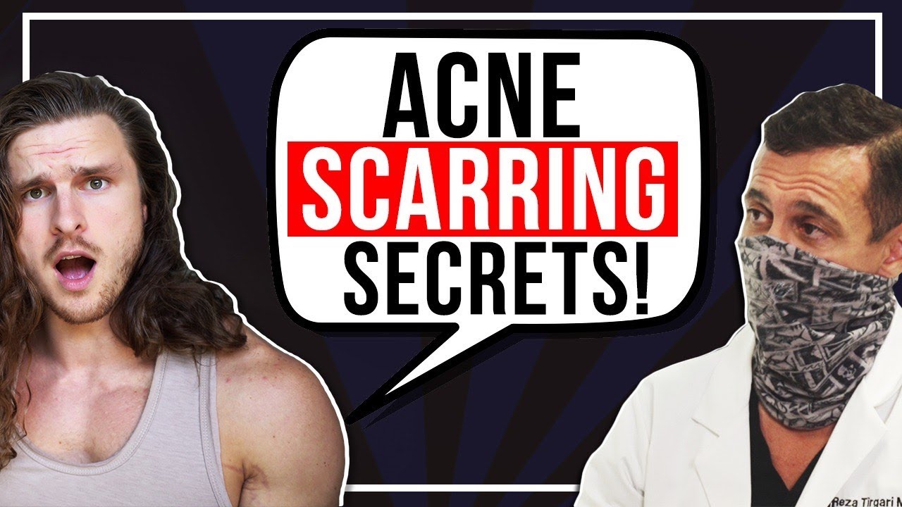 Skin Dr. Explains Best Treatment for Each Type of Acne Scar! 👨🏻‍⚕️🧬