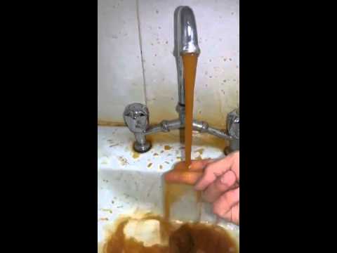 مستشفى عرعر المركزي 2 2 1435