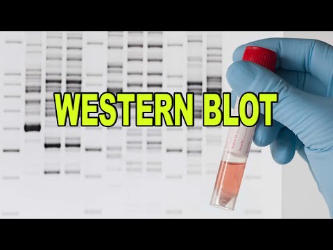 Técnicas inmunológicas | Western Blot