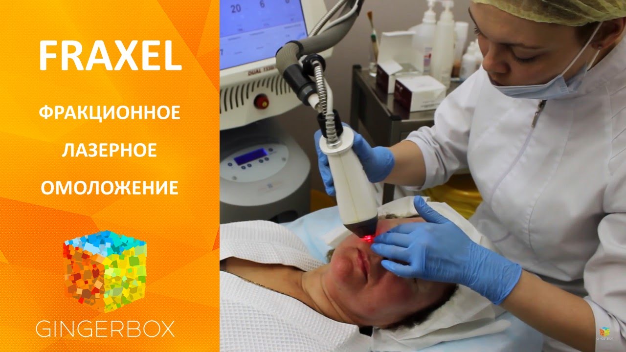 Фраксель - фракционное лазерное омоложение