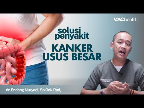 Kanker Usus Besar: