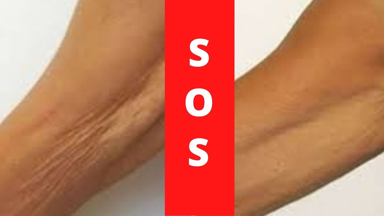 Χαλάρωση στά ΜΠΡΑΤΣΑ   4  SOS Βήματα για ΣΦΙΧΤΑ  ΟΜΟΡΦΑ Χέρια