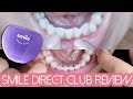 SMILE DIRECT CLUB REVIEW: Final Thoughts