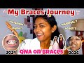 ❤️‍🩹🦷Last QnA On Braces || Last Month With Braces😕 How's Irritating Hurting Wire😭 Miss Archu vlogs 