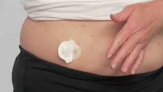 How to Insert a New VariSoft Insulin Pump Infusion Set