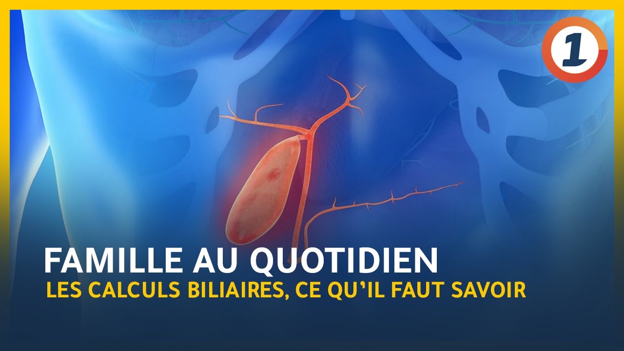 Les calculs biliaires, Ce qu’il faut savoir YouTube — free download