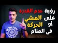 تفسير رؤية عدم القدرة علي المشى أو الشلل في المنام 