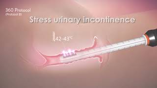 Dr Banta discussing Votiva
