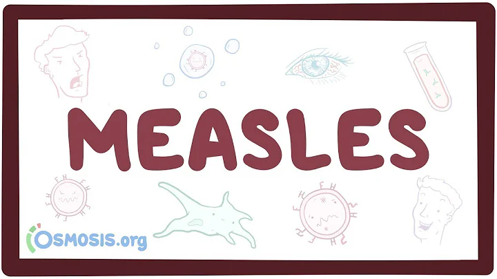Measles - causes, symptoms, diagnosis, treatment, pathology
