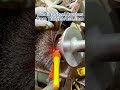Winding Spiral Strip Roller Brush: Everything you need to know for brush roll. #industrialbrush