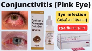 Treatment of Eye Flu in Hindi | Eye flu ( आंखों का चिपकना) का इलाज | Conjunctivitis in hindi