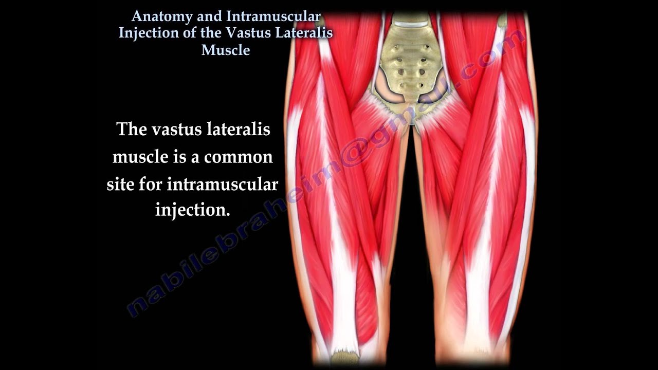 vastus lateralis injection