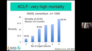 ISG MASTERCLASS I: (16) Stepwise Management of Alcoholic Hepatitis