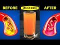Take this in the morning before breakfast  clear clogged arteries and control high blood pressure