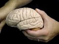 157 Brain Model