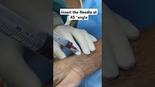 How To Take Abg Sample Abg Sampling Abg Procedure Arterial Blood Gas Abg Ysis