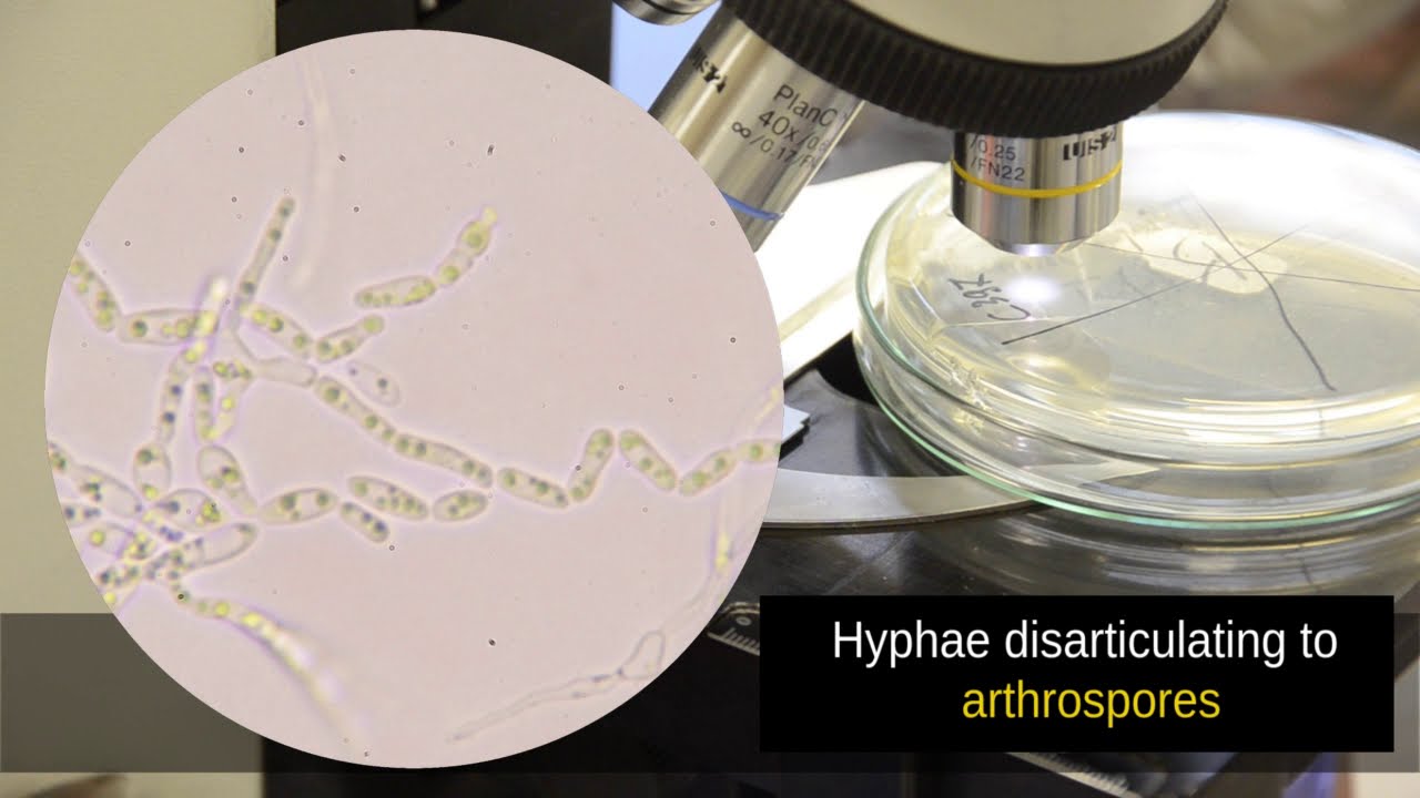 Dalmau Plate Technique yeast culture on starvation medium YouTube