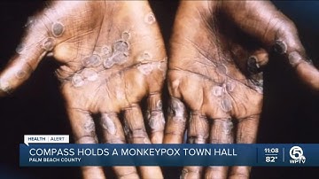 Health experts answer monkeypox questions at town hall