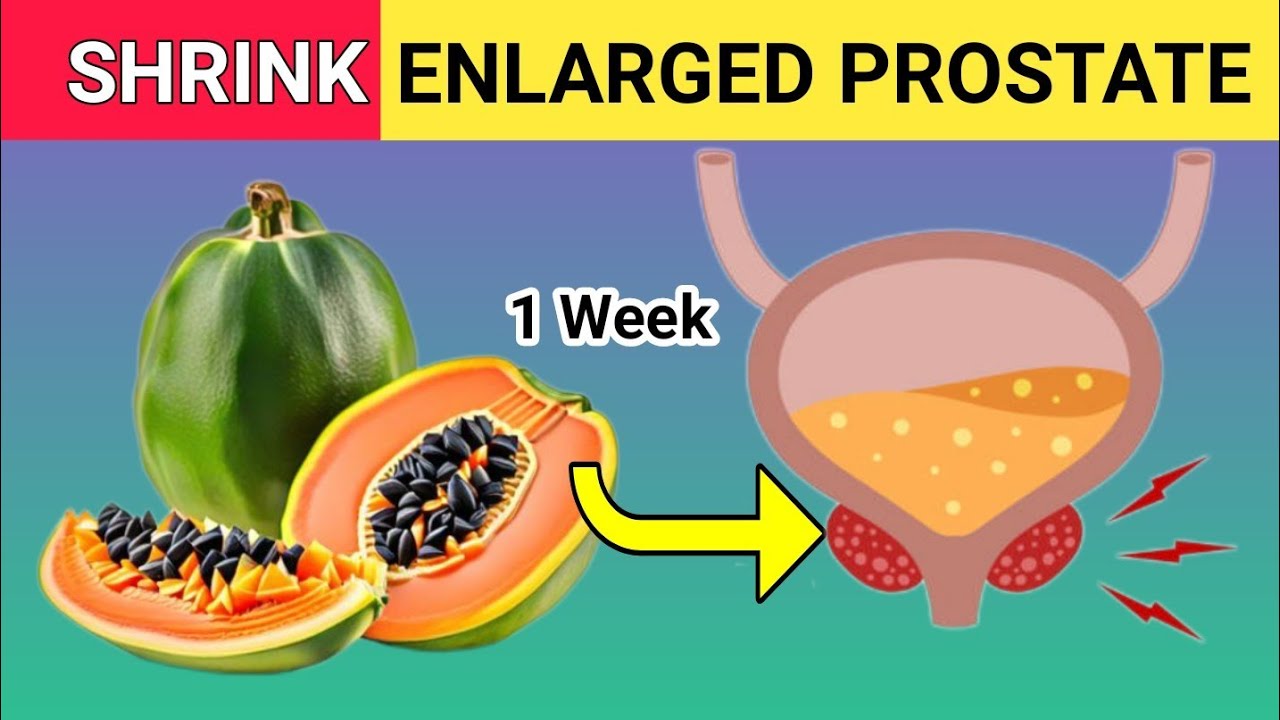 Top 10 Fruits to Shrink an Enlarged Prostate YouTube