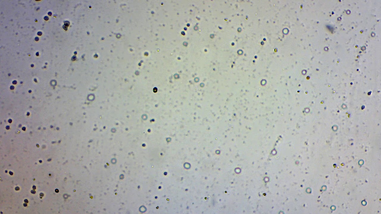 Microbes in pond water - YouTube