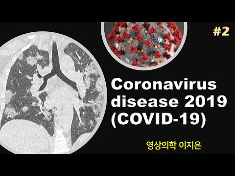 #2-ct-finding-of-coronavirus-disease-2019-(covid-19)-infection,-pneumonia,-코로나바이러스감염증-19