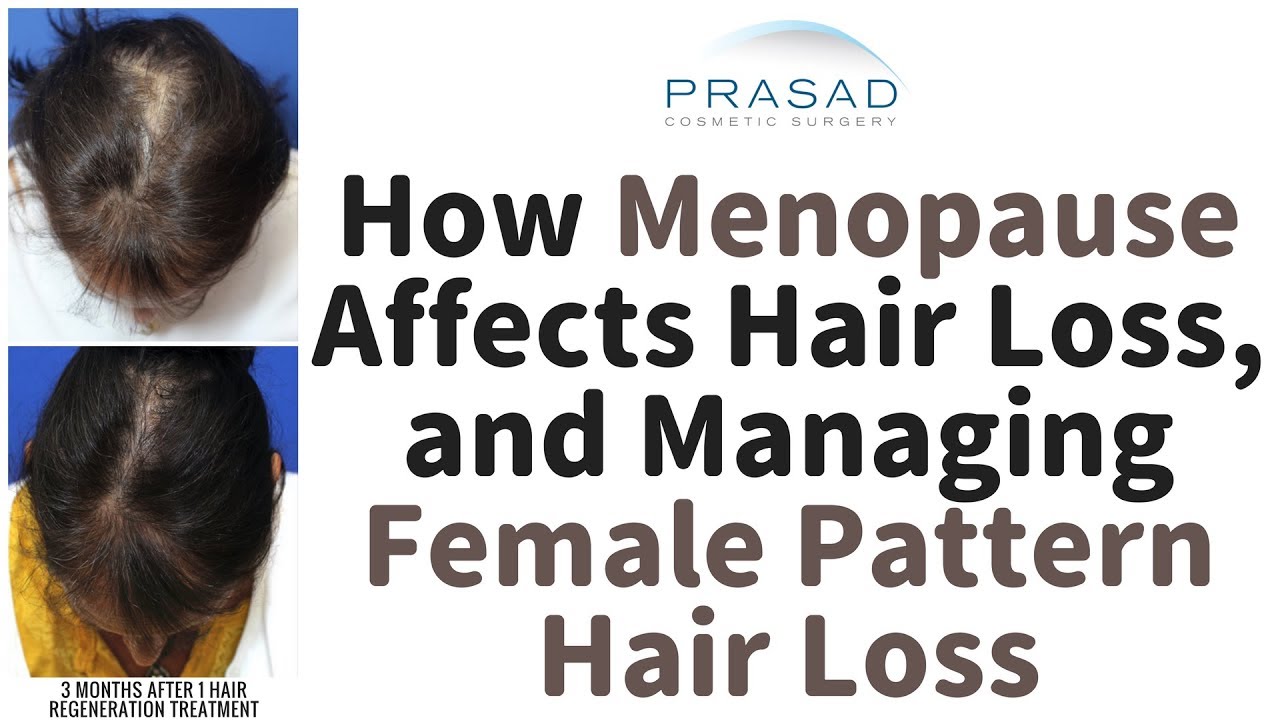 How Pattern Hair Loss Increases in Women Over 50, and How Menopause can  Affect Hair - YouTube
