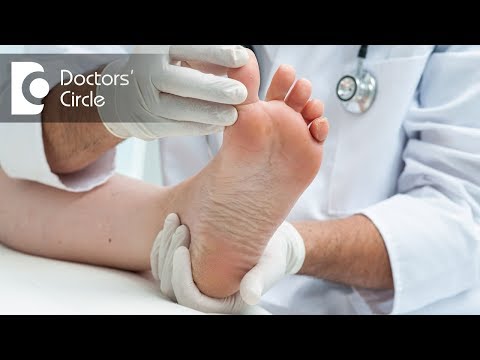 Causes of severe foot pain with normal uric acid - Dr. Mohan M R