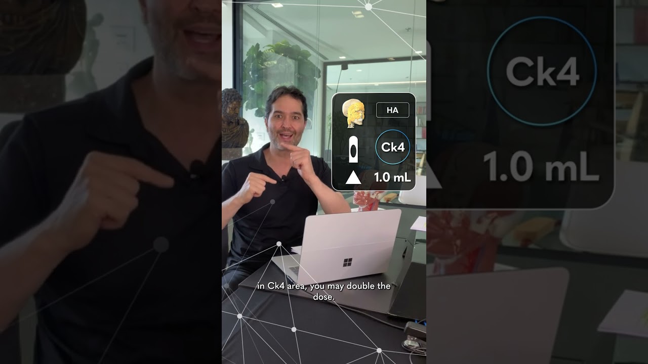 How to treat hollowness in the Cheek? - MD Codes Q&A Session