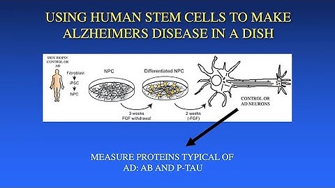 Using Stem Cells to Probe Mechanisms of Neuronal Changes in Alzheimer