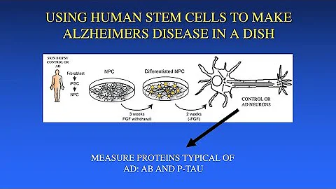Using Stem Cells to Probe Mechanisms of Neuronal Changes in Alzheimer's Disease - Larry Goldstein