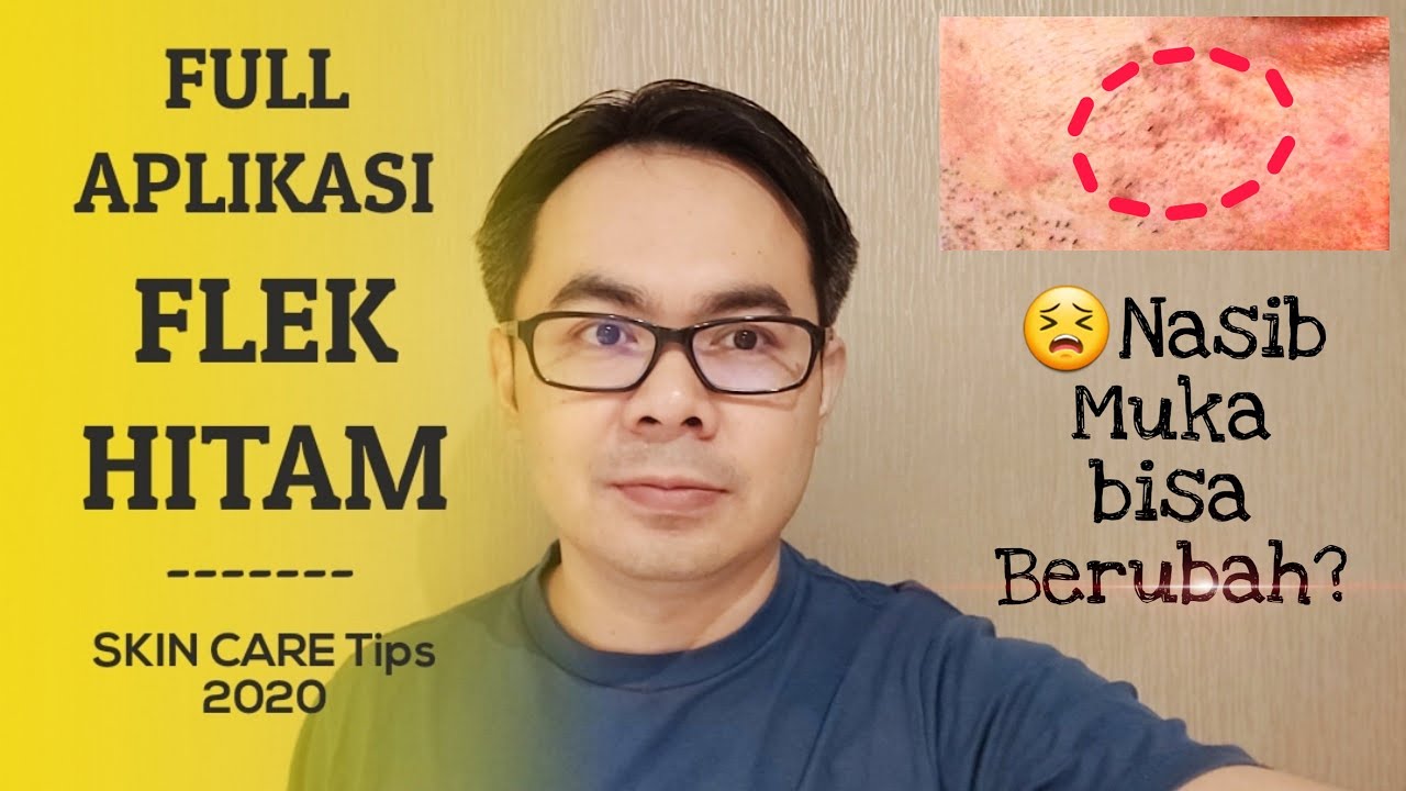 TIPS CARA MENGATASI FLEK HITAM DENGAN KOMBINASI SKIN CARE UPDATE 2020
