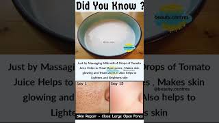 Open pores home remedy | Skin Repair-Close Large Open Pores | Shrink pores to get glass skin #shorts