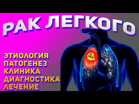 Рак легкого. Признаки, диагностика и методы лечения рака легких.