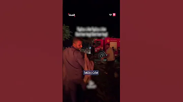 مسعف يسقط قدم طفلة مبتورة خلال نقلها للإسعاف 