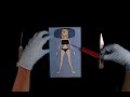 Plastic surgery animation